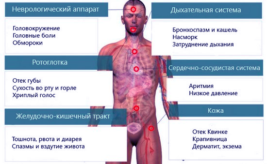 симптомы аллергии у человека