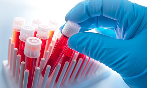 анализ крови на специфические антитела