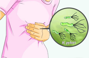 бактерия Helicobacter pylori и боли в животе