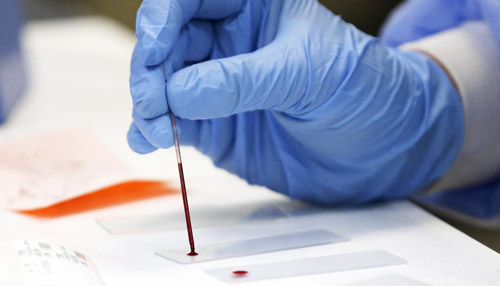 исследование венозной крови на наличие антител 
