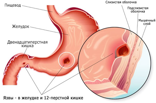 анатомия желудка и двенадцатиперстной кишки
