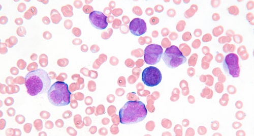 моноциты в крови под микроскопом