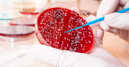 лабораторный посев крови на бактерии