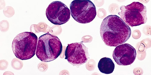 базофилы в крови под микроскопом