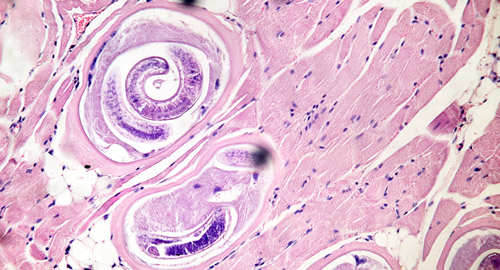 трихинелла в мышцах под микроскопом