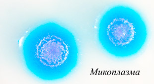 микроорганизмы микоплазм под микроскопом