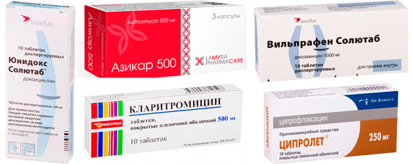 препараты для лечения уреаплазмоза: Юнидокс Солютаб, Азикар, Кларитромицин, Вильпрафен, Ципролет