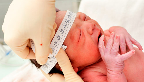 измерение окружности головы новорожденного