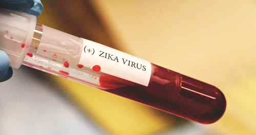 анализ крови на вирус Зика