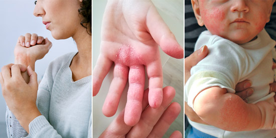 признаки для диагностики заболевания кожи