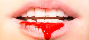 привкус крови во рту