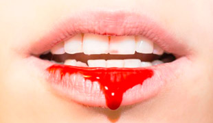 привкус крови во рту
