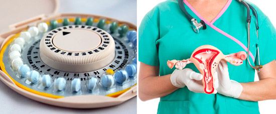 причины выделений: оральные контрацептивы и заболевания матки